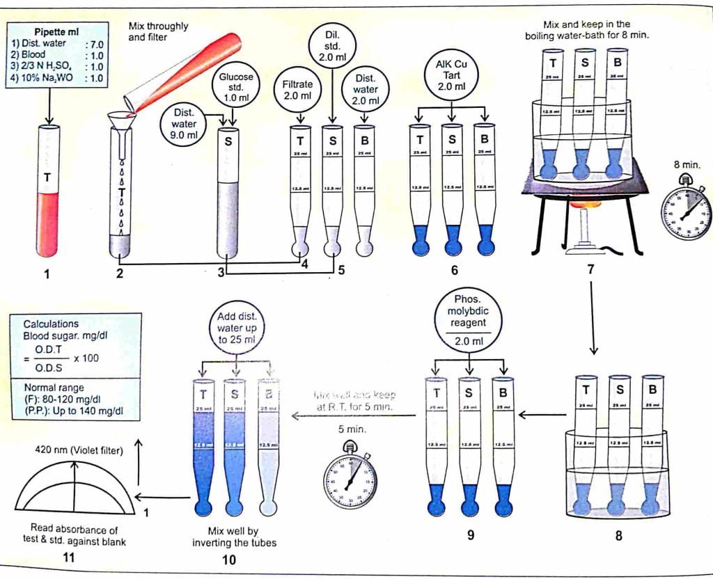 BLOOD SUGAR BY FOLIN- WU'S METHOD