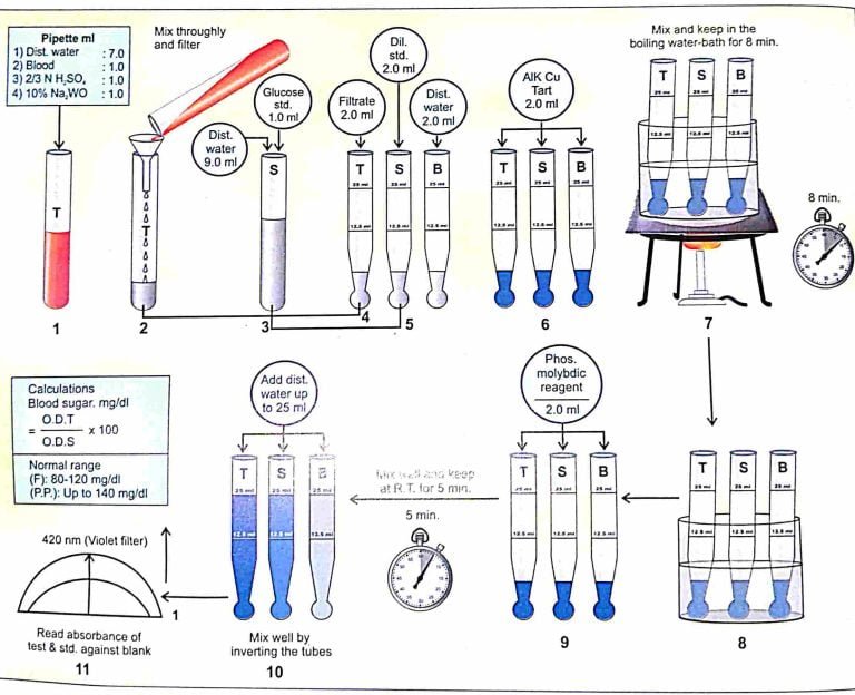 BLOOD SUGAR BY FOLIN- WU'S METHOD
