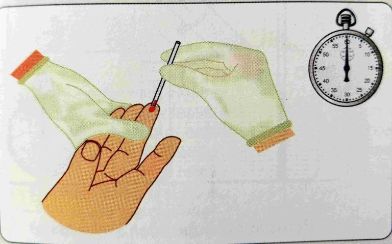 clotting time