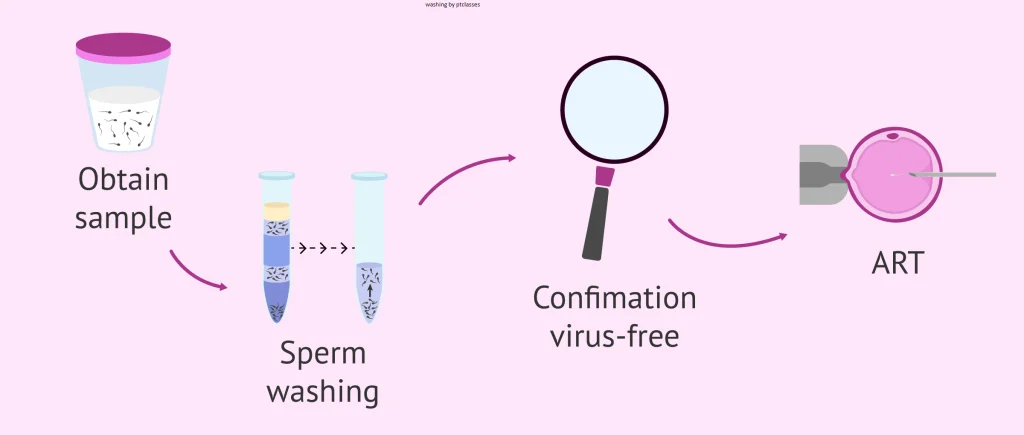 sperm washing