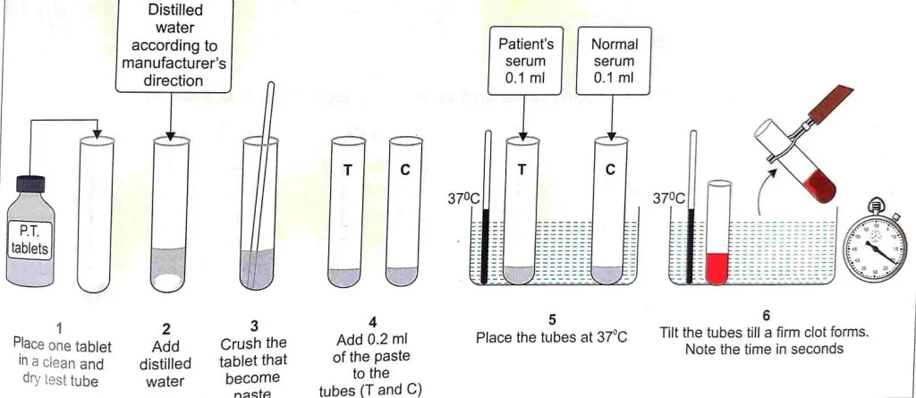 prothrombin time