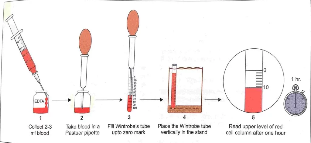 erythrocyte sedimentation rate